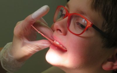 Paura del dentista nei bambini: scopriamo cosa c’è dietro