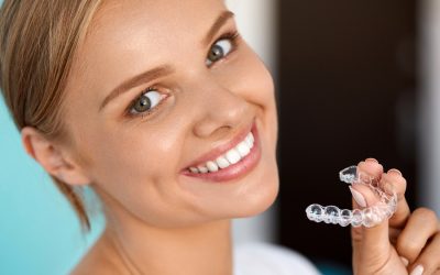 Sbiancare i denti a casa: ecco come funziona passo per passo